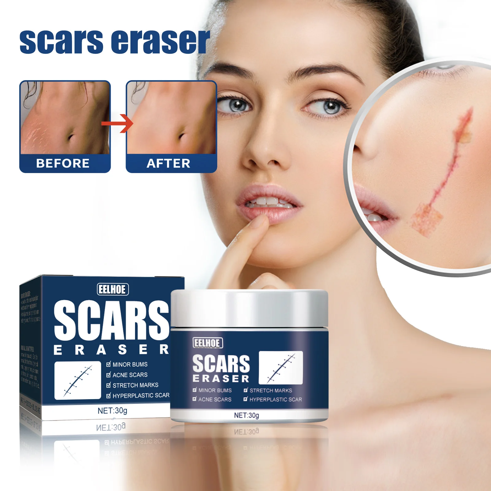 Scar Fading Gel Burn Repair Removal Skin Scars Reduce Pigmentation Restore Skin Elasticity Wound Moisturizing Repairing Cream
Scar Fading Gel Burn Repair Removal Skin Scars Reduce Pigmentation Restore Skin Elasticity Wound Moisturizing Repairing Cream