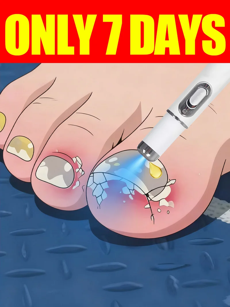 Generation-2 Laser Says Goodbye To Bad Manicure In 7 Days
Generation-2 Laser Says Goodbye To Bad Manicure In 7 Days