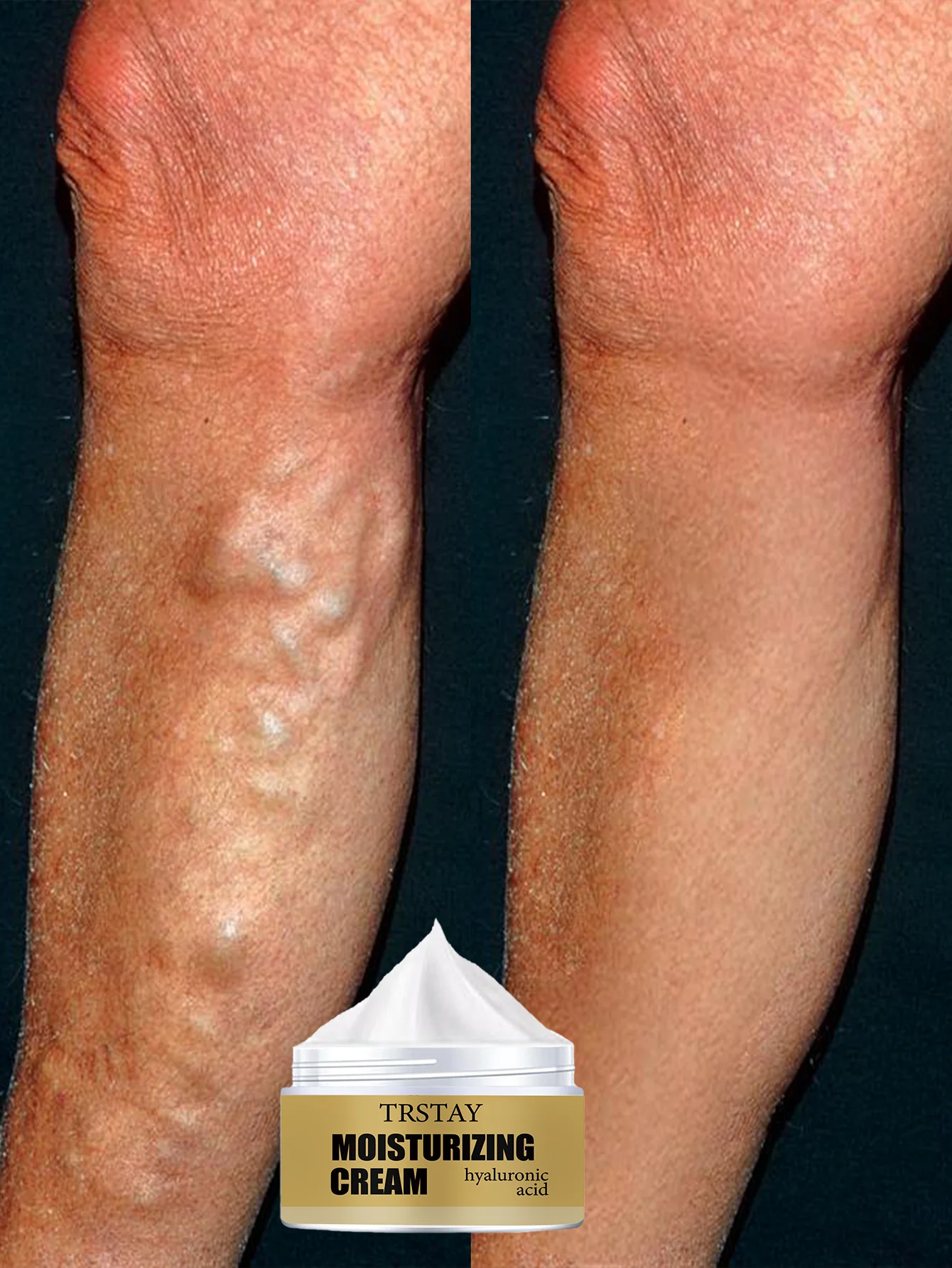 Увлажняющий крем для тела от варикозного расширения вен, улучшения кровообращения и облегчения чувствительной кожи с нежной формулой для успокаивания земли
Увлажняющий крем для тела от варикозного расширения вен, улучшения кровообращения и облегчения чувствительной кожи с нежной формулой для успокаивания земли