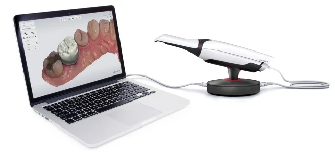 Buy 5 Get 3 Free 3Shape TRIOS 4 Intraoral Scanner wireless
Buy 5 Get 3 Free 3Shape TRIOS 4 Intraoral Scanner wireless