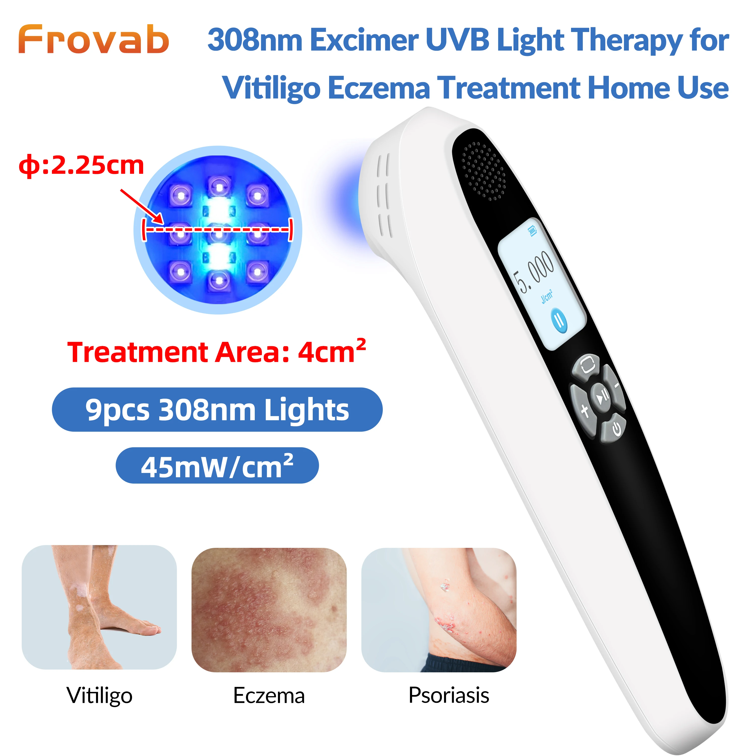 Handheld uvb Light Therapy 308nm Portable Effective To Treat vitiligo Psoriasis Eczema Uvb Lamps Uv Phototherapy Instrinstrumen
Handheld uvb Light Therapy 308nm Portable Effective To Treat vitiligo Psoriasis Eczema Uvb Lamps Uv Phototherapy Instrinstrumen