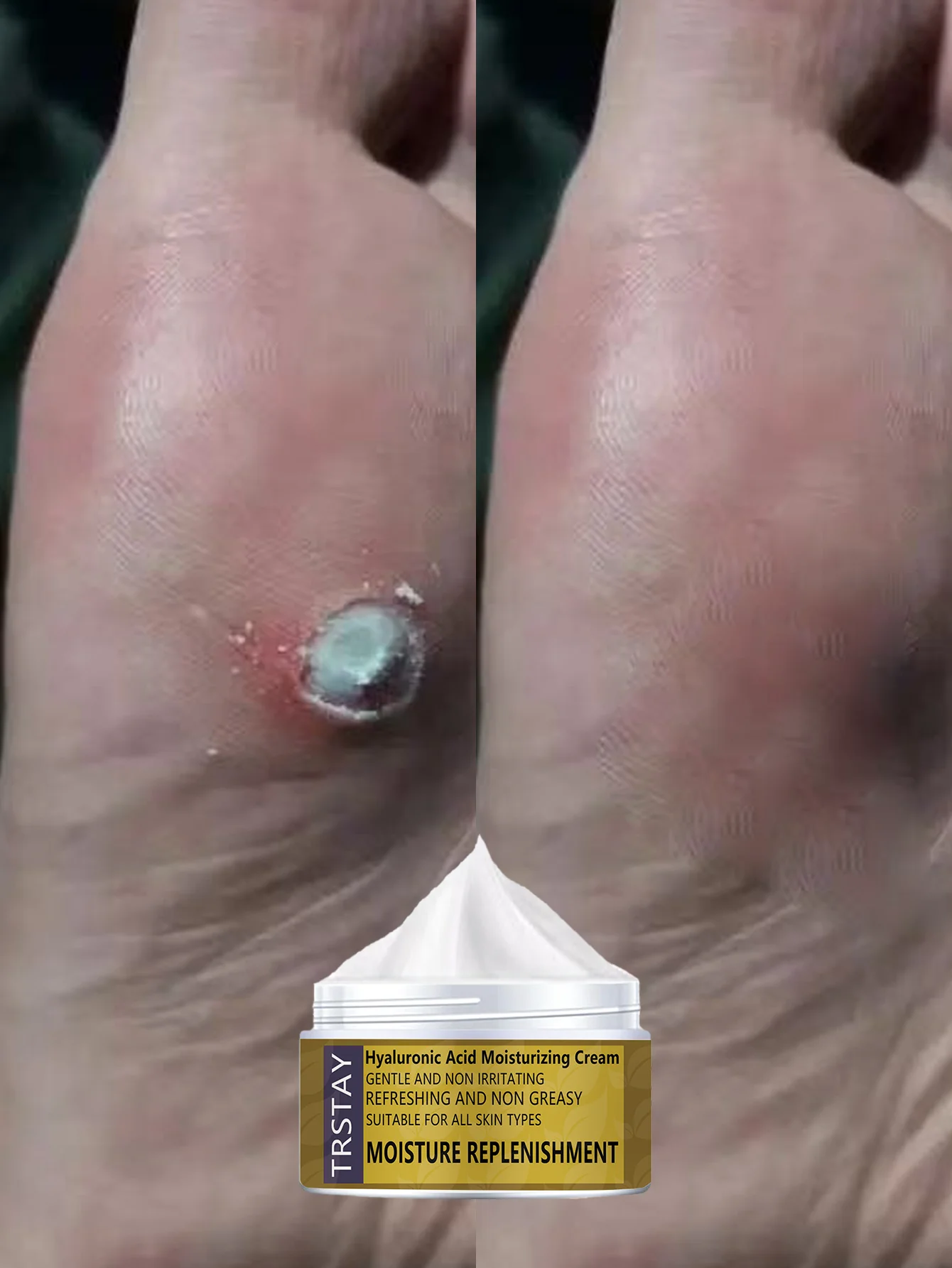 Увлажняющий крем для ног для сухих потрескавшихся пяток, глубоко увлажняет, восстанавливает грубую кожу, смягчает подошвы, предотвращает потерю влаги, обогащенный w
Увлажняющий крем для ног для сухих потрескавшихся пяток, глубоко увлажняет, восстанавливает грубую кожу, смягчает подошвы, предотвращает потерю влаги, обогащенный w