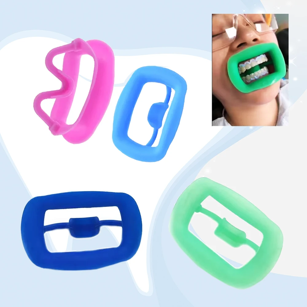 Dental Mouth Opener Soft Silicone Cheek Retractor for Orthodontic Intraoral Lip Expansion Teeth Whitening Tool
Dental Mouth Opener Soft Silicone Cheek Retractor for Orthodontic Intraoral Lip Expansion Teeth Whitening Tool