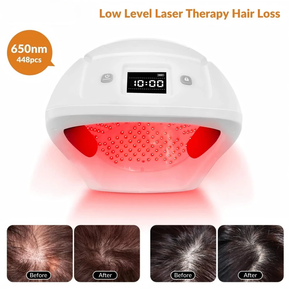 ZJZK 448 Diodes Hair Growth Cap Anti Hair Loss Laser Helmet 650nm LLLT Device for Stimulates Regrowth & Thickening Hair Care
ZJZK 448 Diodes Hair Growth Cap Anti Hair Loss Laser Helmet 650nm LLLT Device for Stimulates Regrowth & Thickening Hair Care