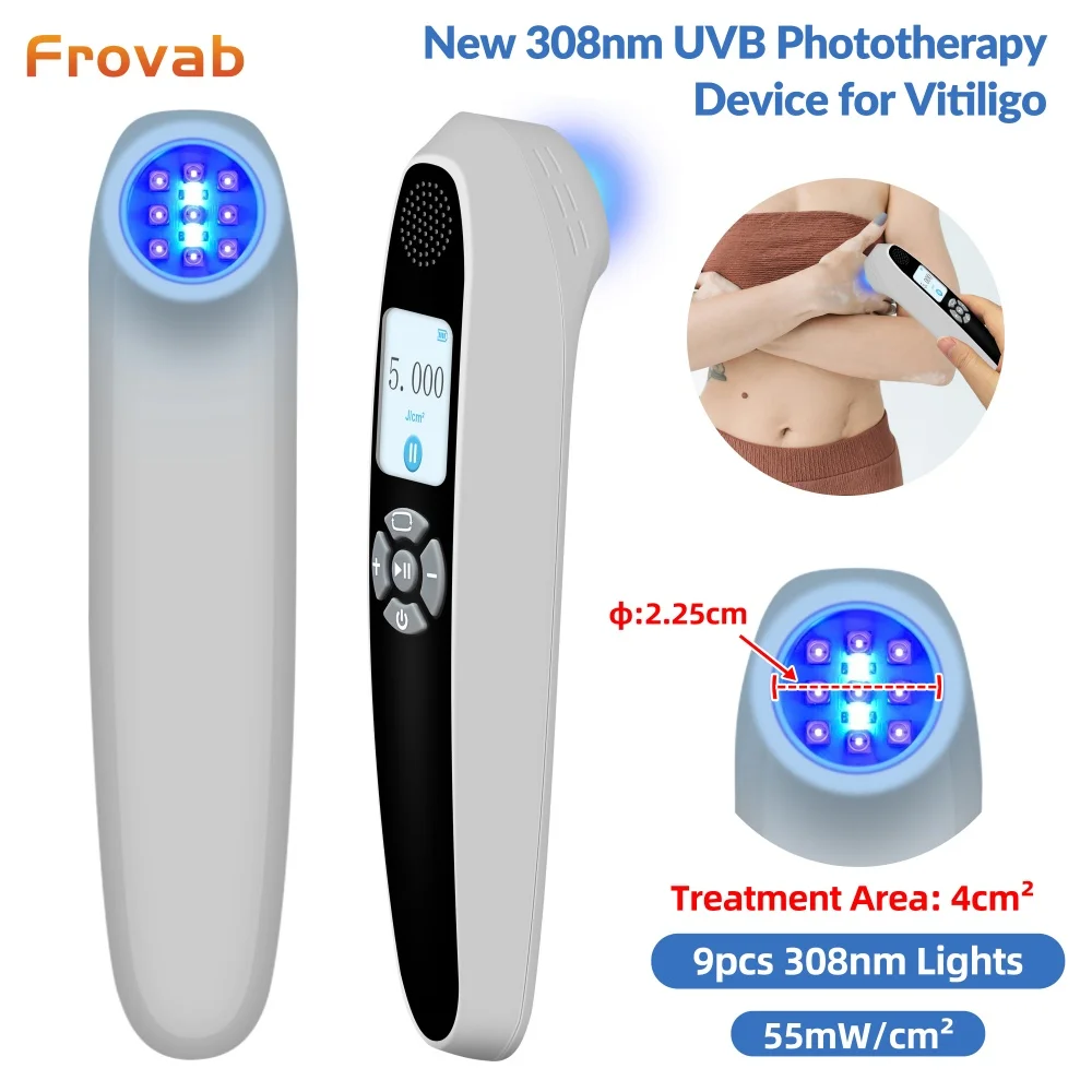 Медицинская УФБ-лампа 308 нм для фототерапии, 55 мВт/см², целенаправленное лечение витилиго, псориаза, экземы, белых пятен, дерматита
Медицинская УФБ-лампа 308 нм для фототерапии, 55 мВт/см², целенаправленное лечение витилиго, псориаза, экземы, белых пятен, дерматита