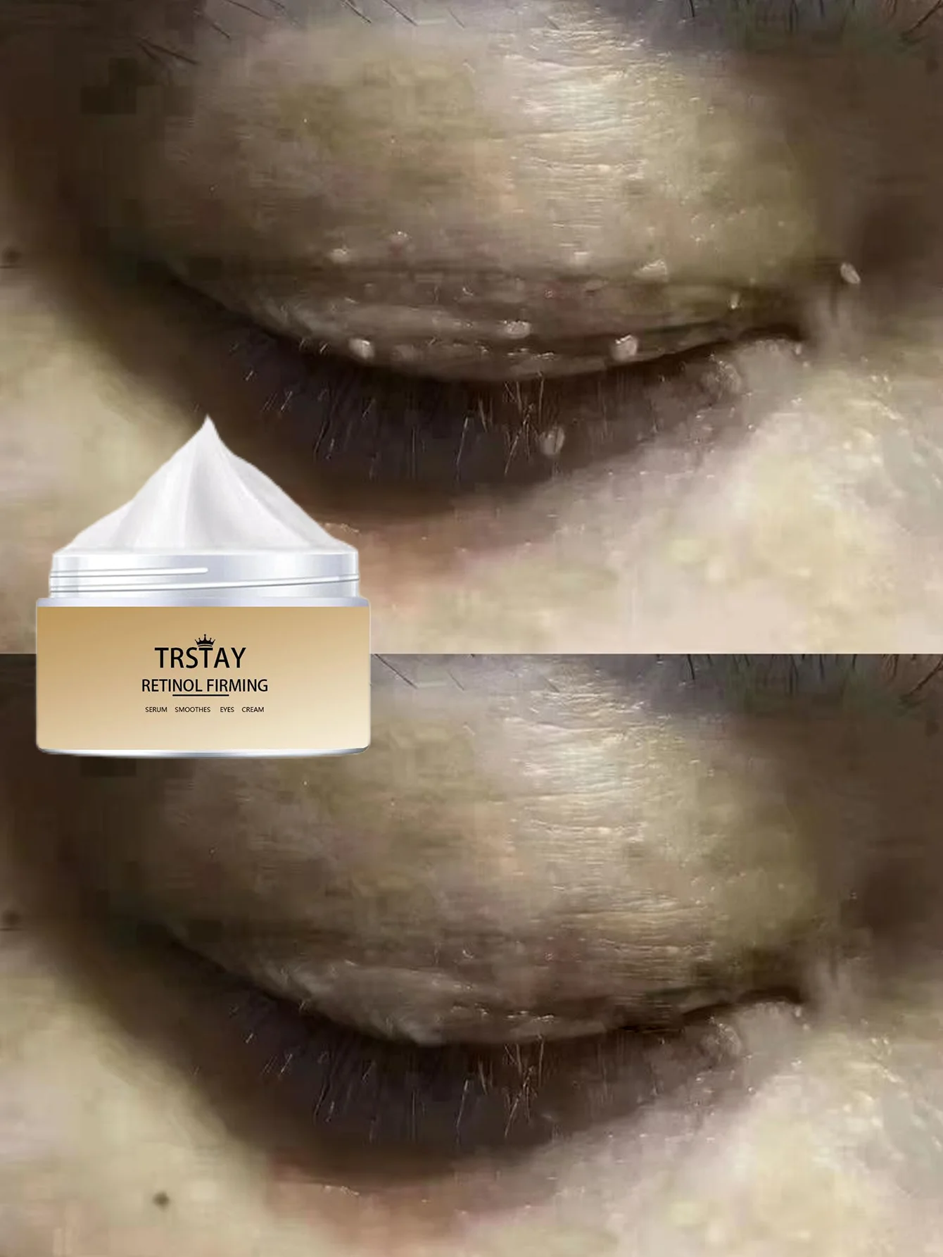 Moisturizing and Smoothing Face Cream for Reducing Local Graininess Deep Hydration and Skin Softening Serum with Soothing Formul
Moisturizing and Smoothing Face Cream for Reducing Local Graininess Deep Hydration and Skin Softening Serum with Soothing Formul