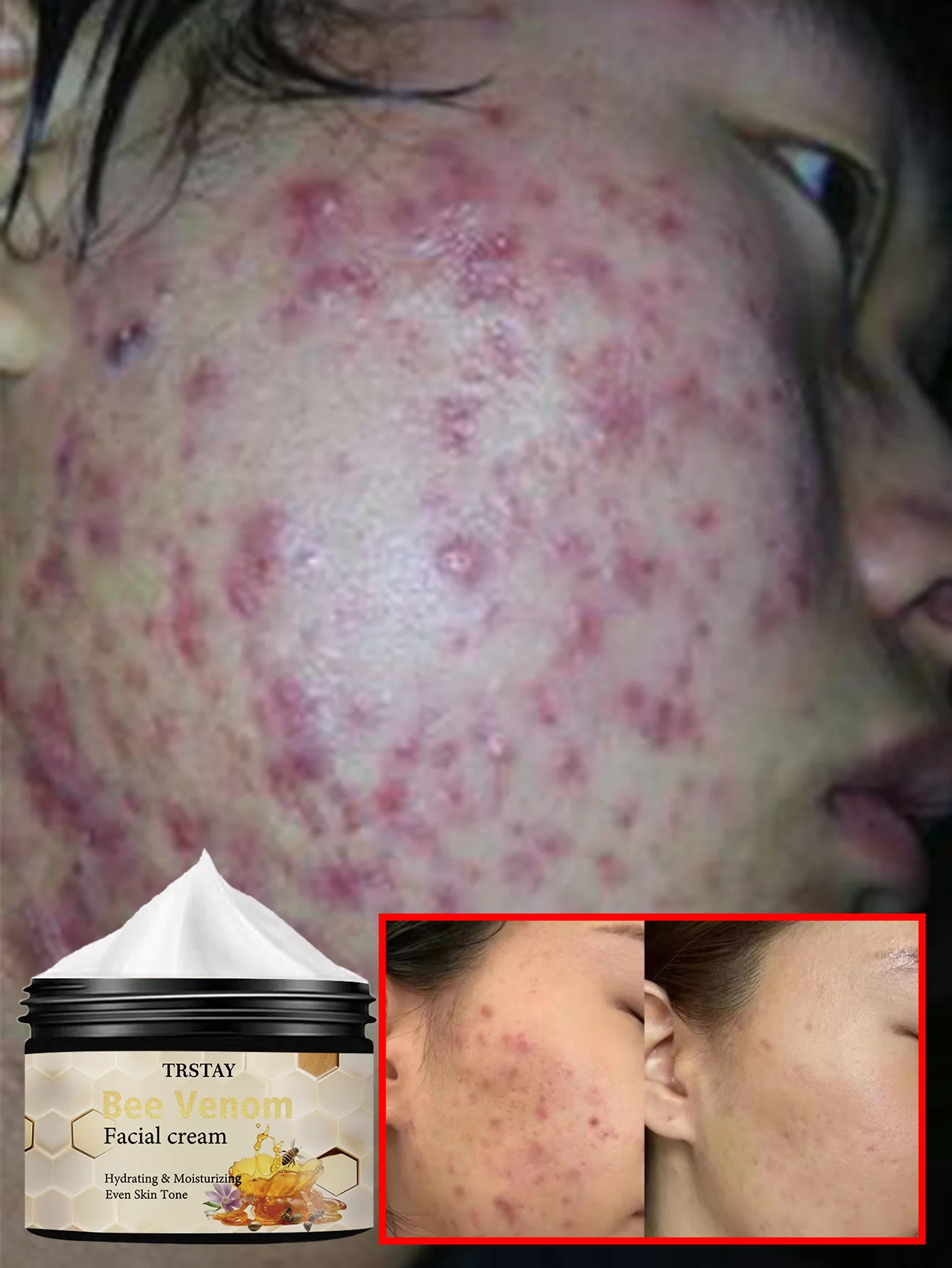 Легкая увлажняющая сыворотка Formula Oil Balance Formula для контроля блеска и осветления ухода за лицом с процедуры балансировки жирности
Легкая увлажняющая сыворотка Formula Oil Balance Formula для контроля блеска и осветления ухода за лицом с процедуры балансировки жирности