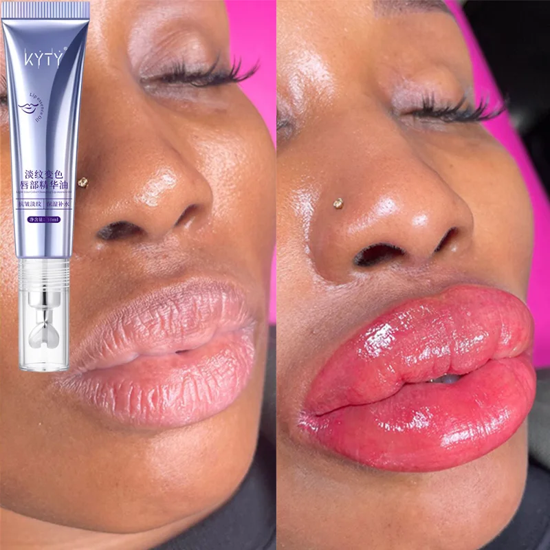 Fade Lip Lines Lipstick Whitening Lip Remove Dead Skin Dark Lips Mask Gloss Oil Exfoliating Cleaning Moisturizing Lip Essence
Fade Lip Lines Lipstick Whitening Lip Remove Dead Skin Dark Lips Mask Gloss Oil Exfoliating Cleaning Moisturizing Lip Essence