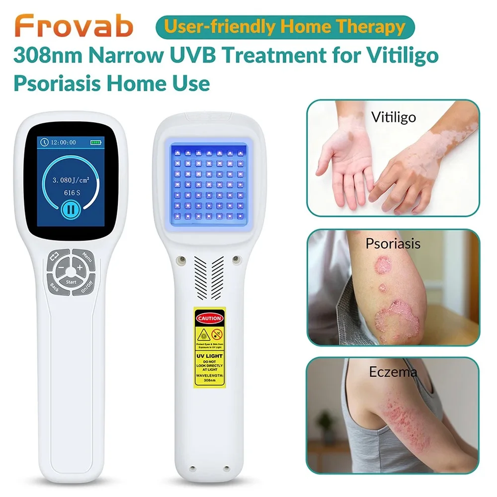 Frovab Handheld 308nm Excimer UVB Phototherapy Device Portable Vitiligo Psoriasis Eczema Treatment Lamp for Skin Diseases
Frovab Handheld 308nm Excimer UVB Phototherapy Device Portable Vitiligo Psoriasis Eczema Treatment Lamp for Skin Diseases