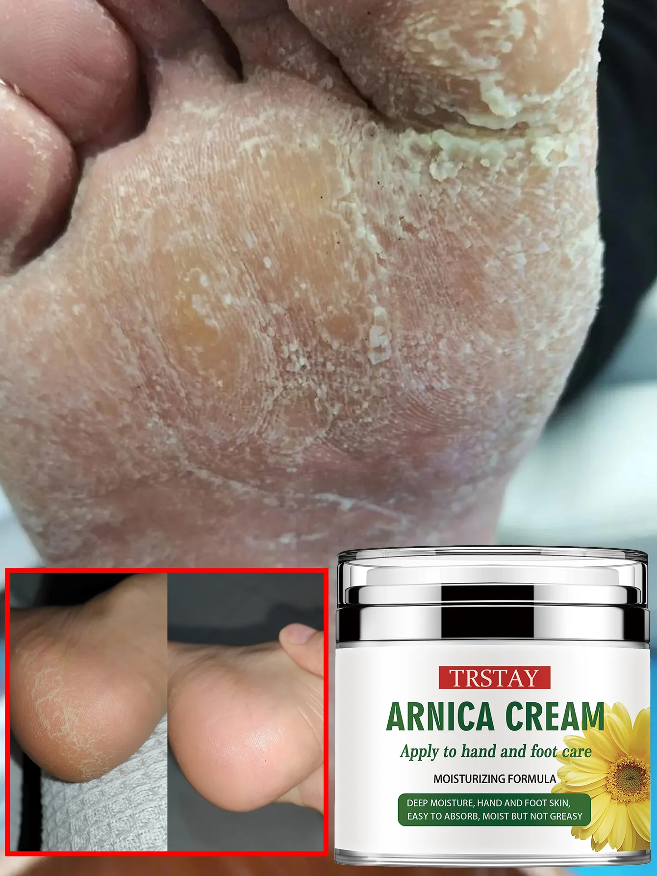 Увлажняющая эссенция для ухода за омертвевшей кожей ног, восстанавливает сухие потрескавшиеся ноги, мягкая гладкая кожа, облегчение глубокого увлажнения для потрескавшихся пяток и R
Увлажняющая эссенция для ухода за омертвевшей кожей ног, восстанавливает сухие потрескавшиеся ноги, мягкая гладкая кожа, облегчение глубокого увлажнения для потрескавшихся пяток и R