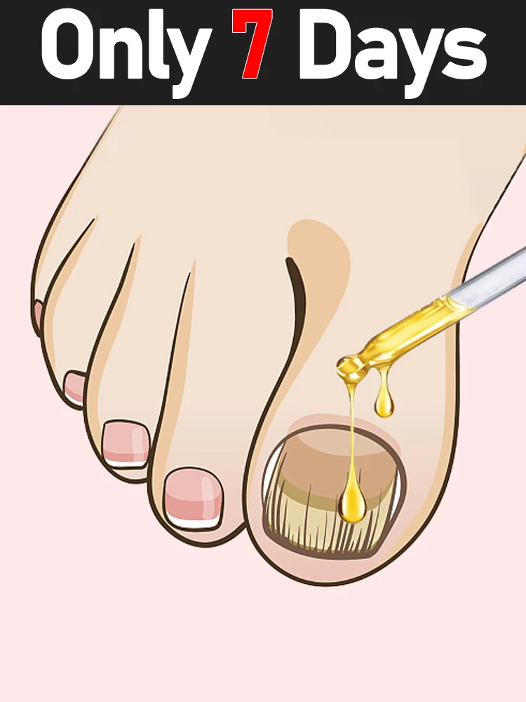 Эта сыворотка для ногтей борется с грибковыми инфекциями, укрепляет ногти и восстанавливает их здоровый вид.
Эта сыворотка для ногтей борется с грибковыми инфекциями, укрепляет ногти и восстанавливает их здоровый вид.