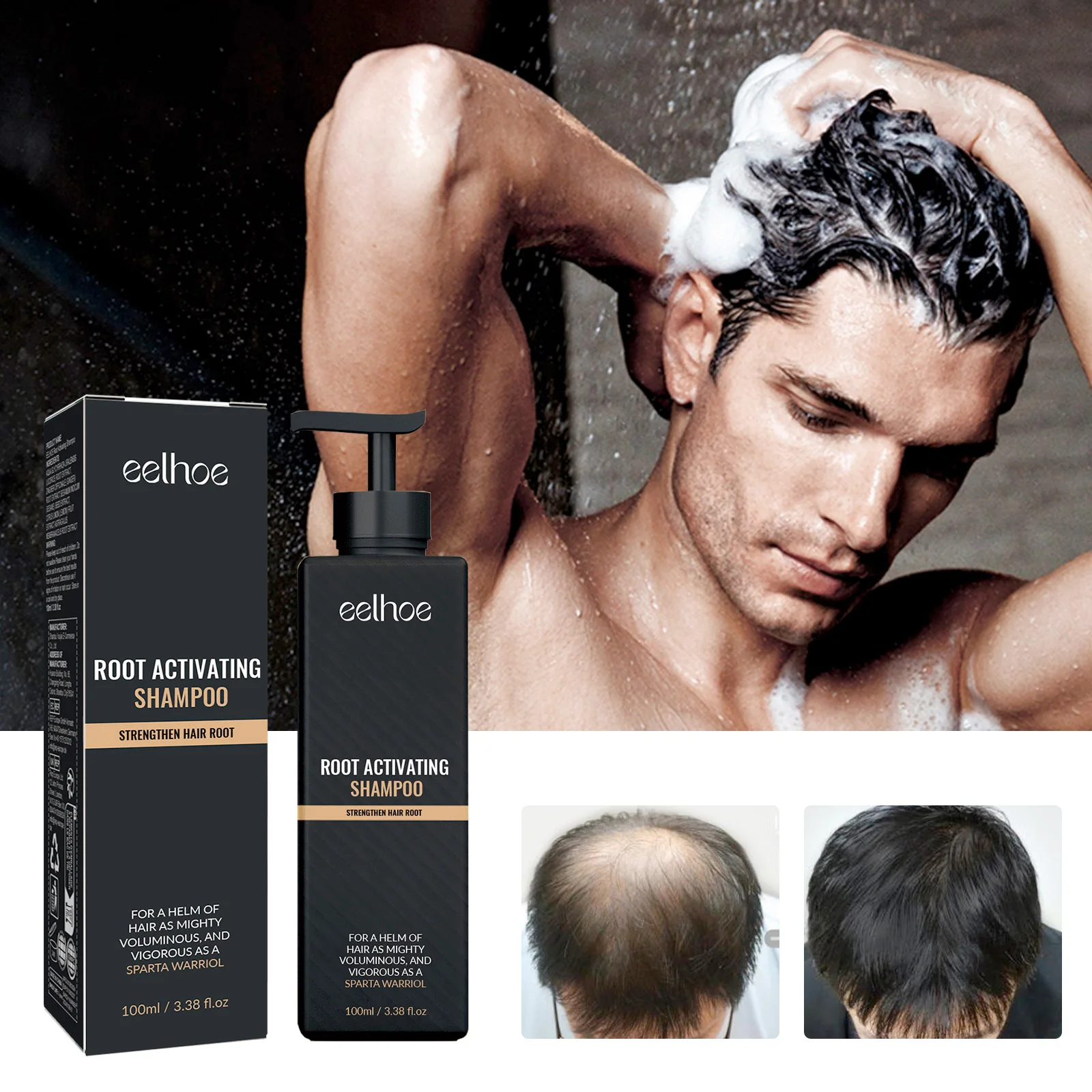 100ml Eelhoe Hair Density Shampoo Hair Fall Control Boost Care Botanical Nourish Anti Dandruff Itch Relief Shampoo Treatment
100ml Eelhoe Hair Density Shampoo Hair Fall Control Boost Care Botanical Nourish Anti Dandruff Itch Relief Shampoo Treatment