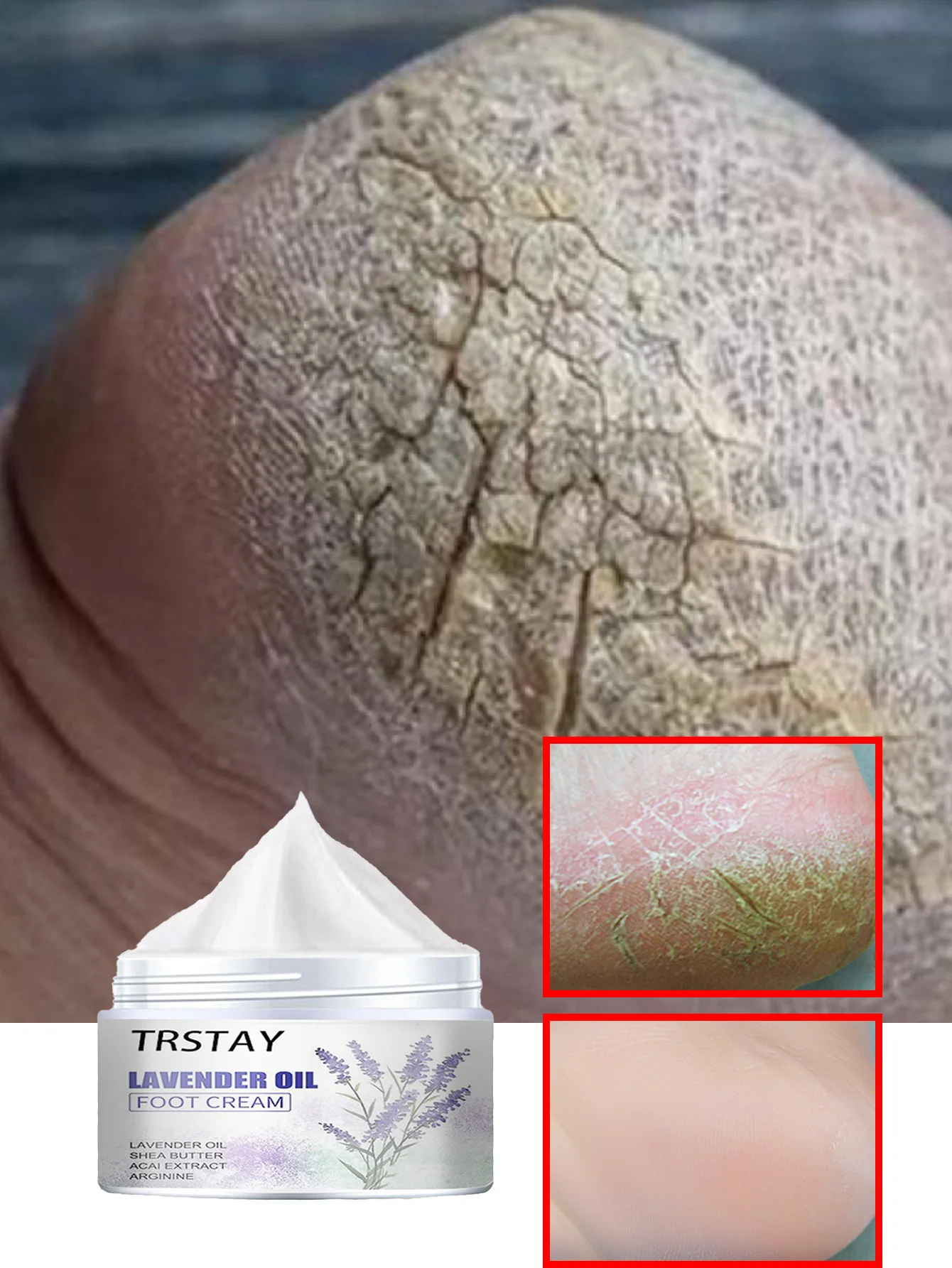 Foot Hydration Oil for Cracked Heels Fast Absorption Deep Moisturizing Treatment for Dry Rough Feet Repairing Foot Care Essentia
Foot Hydration Oil for Cracked Heels Fast Absorption Deep Moisturizing Treatment for Dry Rough Feet Repairing Foot Care Essentia