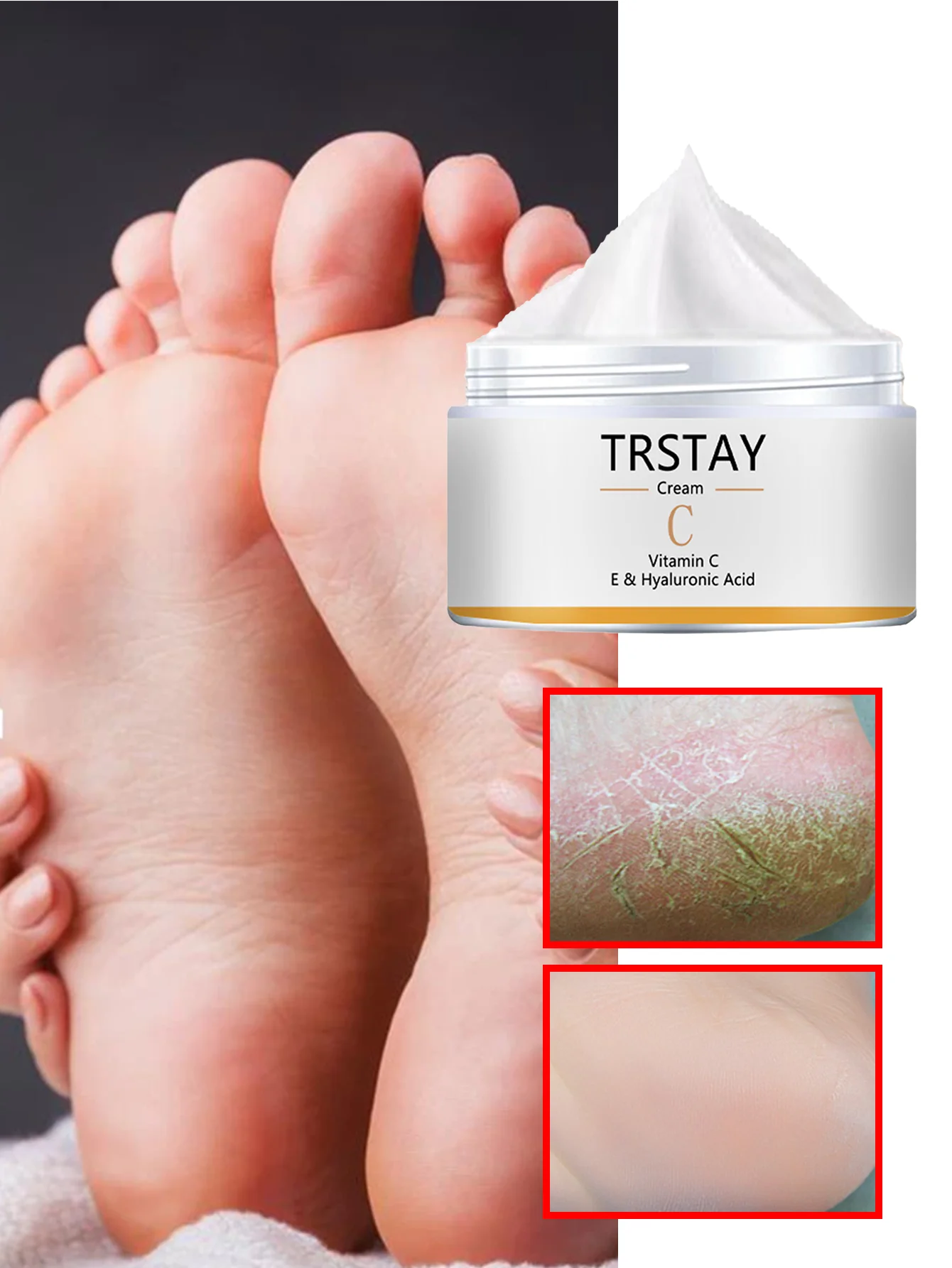 Увлажняющее масло для ног для потрескавшихся пяток Быстрое впитывание Увлажняющее лечение Уход за сухой кожей Восстанавливающая формула Натуральные ингредиенты
Увлажняющее масло для ног для потрескавшихся пяток Быстрое впитывание Увлажняющее лечение Уход за сухой кожей Восстанавливающая формула Натуральные ингредиенты