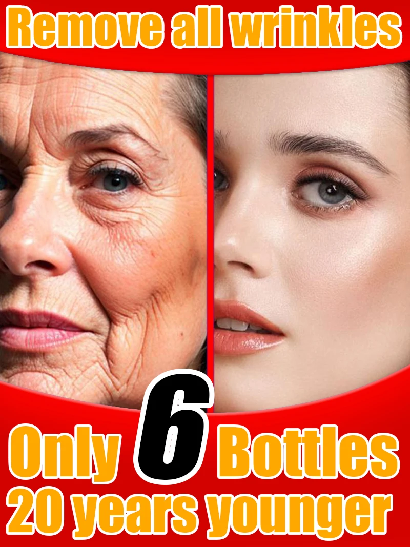 From Wrinkles to Wrinkle Free
From Wrinkles to Wrinkle Free