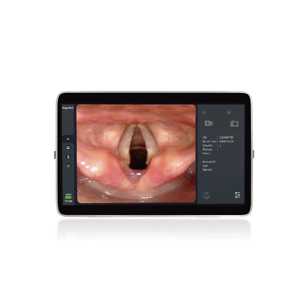 BRAND NEW 7.5FR Single Use Digital Video Flexible Ureteroscope Price Disposable Portable Urology Ureteroscope
BRAND NEW 7.5FR Single Use Digital Video Flexible Ureteroscope Price Disposable Portable Urology Ureteroscope