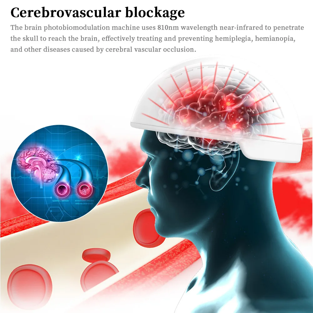 Infrared 810nm Neurofeedback Therapy Machine Pdt Treatment Photodynamic Transcranial Magnetic Brain Photobiomodulation
Infrared 810nm Neurofeedback Therapy Machine Pdt Treatment Photodynamic Transcranial Magnetic Brain Photobiomodulation