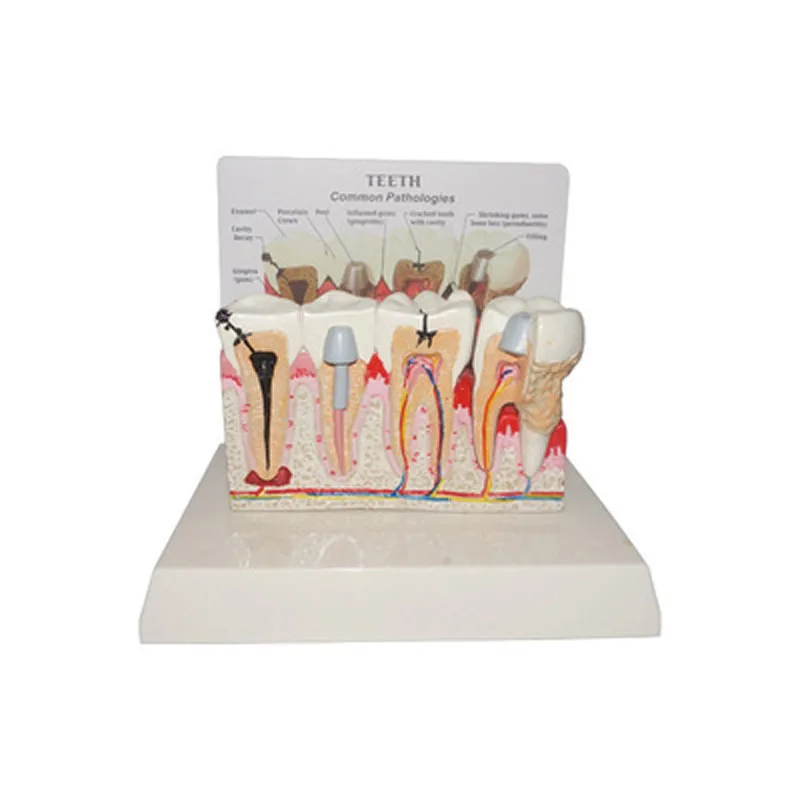 Standard Dental Oral Teeth Anatomical Teaching Model Comprehensive Tooth Structure Model Dentist Dental Student Demonstration
Standard Dental Oral Teeth Anatomical Teaching Model Comprehensive Tooth Structure Model Dentist Dental Student Demonstration
