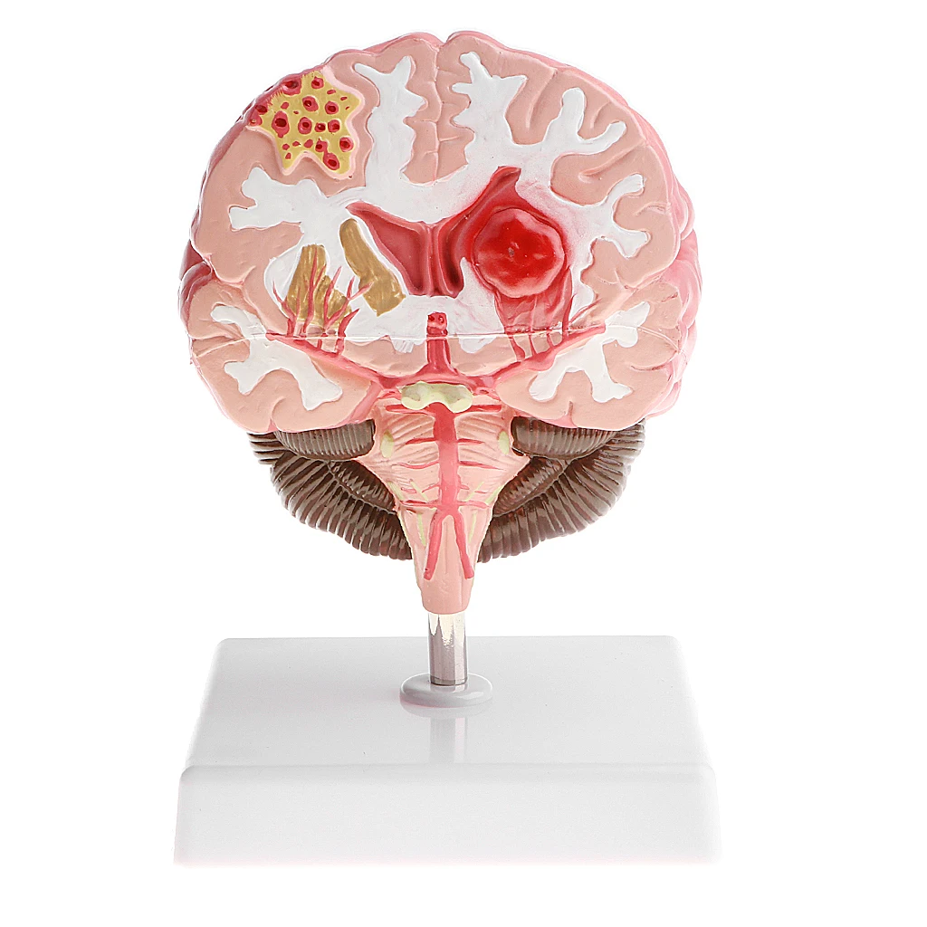 Anatomical Human's Brain Disease Pathological Model Medical Teaching Tool Lab Display Model Education Human's Brain Model
Anatomical Human's Brain Disease Pathological Model Medical Teaching Tool Lab Display Model Education Human's Brain Model