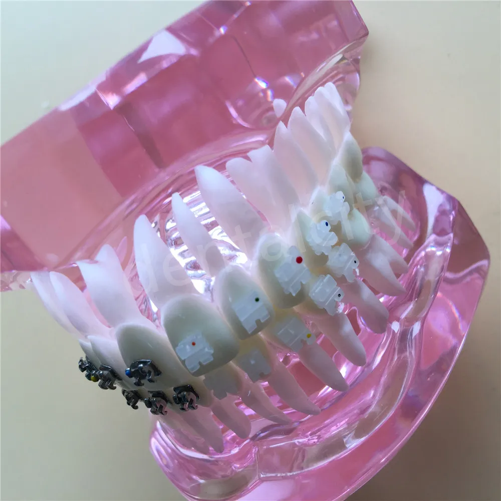 Dental Orthodontic Model with Metal and Ceramic Brackets Dental Teeth Study Model 3003 Pink
Dental Orthodontic Model with Metal and Ceramic Brackets Dental Teeth Study Model 3003 Pink