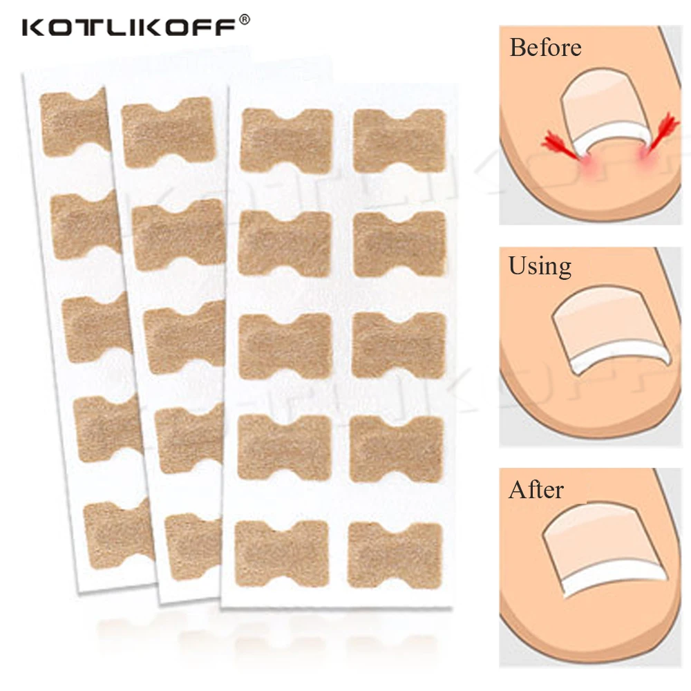 KOTLIKOFF 1 PCS Paronychia Treatment Patch Tool Straightening Clipper Sticker Ingrown Toenail Correction Toe Nail Pedicure Tool
KOTLIKOFF 1 PCS Paronychia Treatment Patch Tool Straightening Clipper Sticker Ingrown Toenail Correction Toe Nail Pedicure Tool