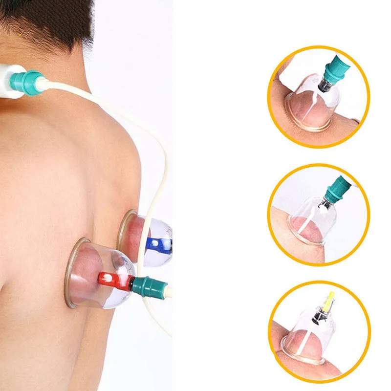 24 Cans Household Cupping Set Vacuum Suction Cup Pump Chinese Acupuncture Magnetic Therapy Body Back Massage Health Care
24 Cans Household Cupping Set Vacuum Suction Cup Pump Chinese Acupuncture Magnetic Therapy Body Back Massage Health Care