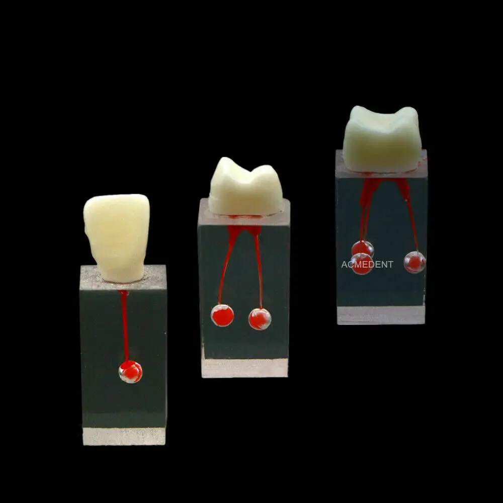 3Type Dental Model Endodontic Root Canal Block Practice Pulp Crown Cavity Study
3Type Dental Model Endodontic Root Canal Block Practice Pulp Crown Cavity Study