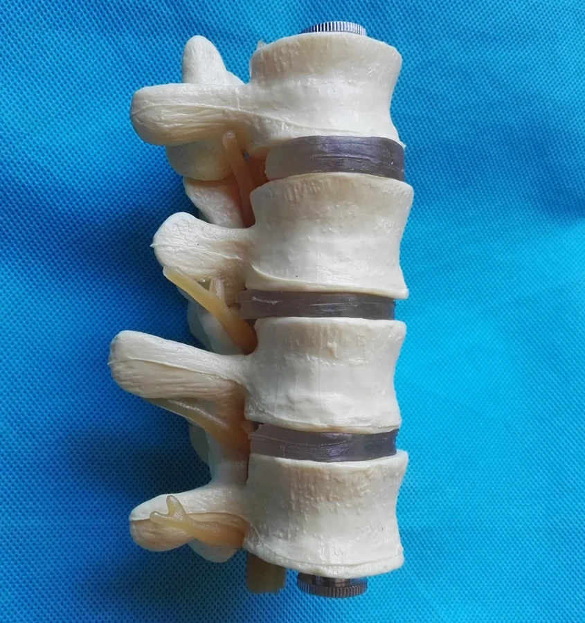 4 секции, детская звезда, набор из сплава, поясничный диск, демонстрационная модель, детская звезда, модель скелета человека
4 секции, детская звезда, набор из сплава, поясничный диск, демонстрационная модель, детская звезда, модель скелета человека