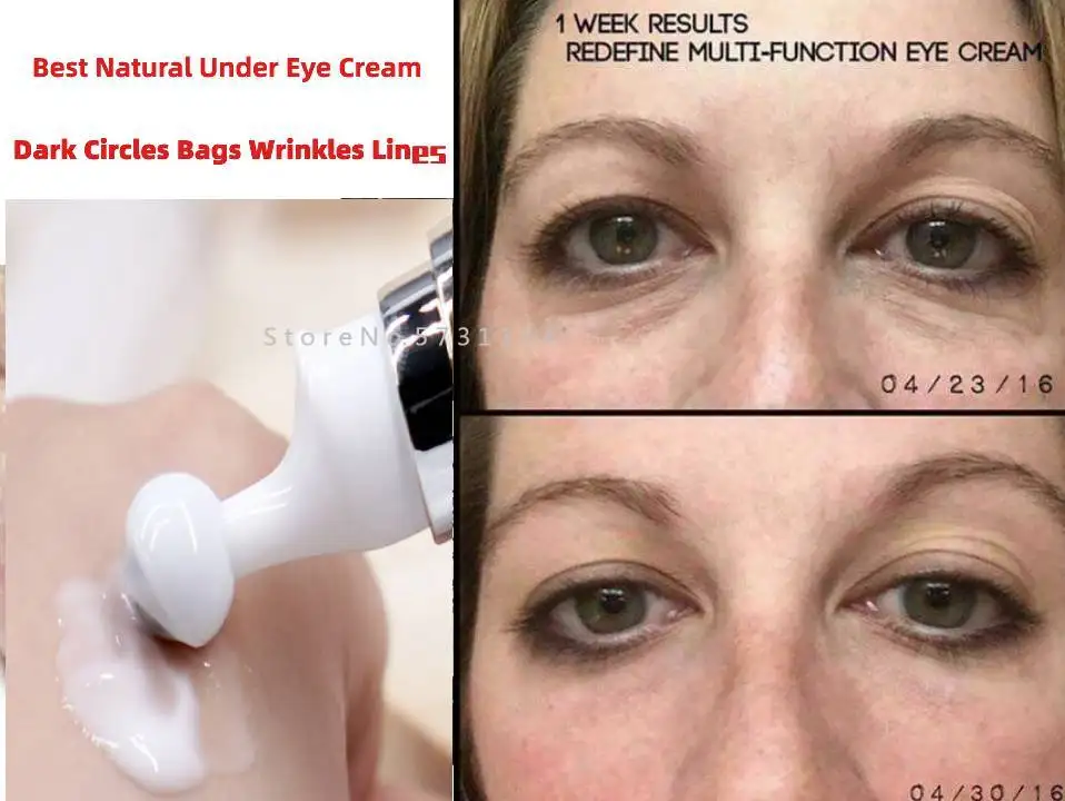Best Natural Under Eye Cream Dark Circles Bags Wrinkles Lines Lift Puffiness 10ml
Best Natural Under Eye Cream Dark Circles Bags Wrinkles Lines Lift Puffiness 10ml