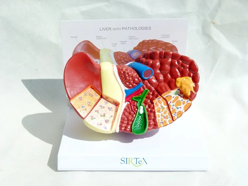 Human liver anatomical pathology model 
Human liver anatomical pathology model