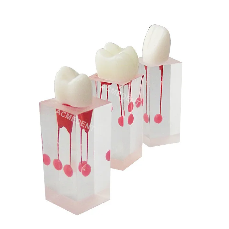 5Pcs Dental File Train RCT Root Canal Teeth Study Practice Model Endodontic Pulp Inflammation Apical
5Pcs Dental File Train RCT Root Canal Teeth Study Practice Model Endodontic Pulp Inflammation Apical