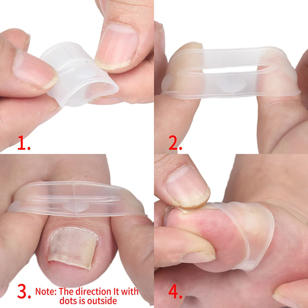 2PCS Ingrown Toenail Correction Tool Toe Cap Toenail Protector Big Toe Sleeves Thick Paronychia Correction Tool
2PCS Ingrown Toenail Correction Tool Toe Cap Toenail Protector Big Toe Sleeves Thick Paronychia Correction Tool
