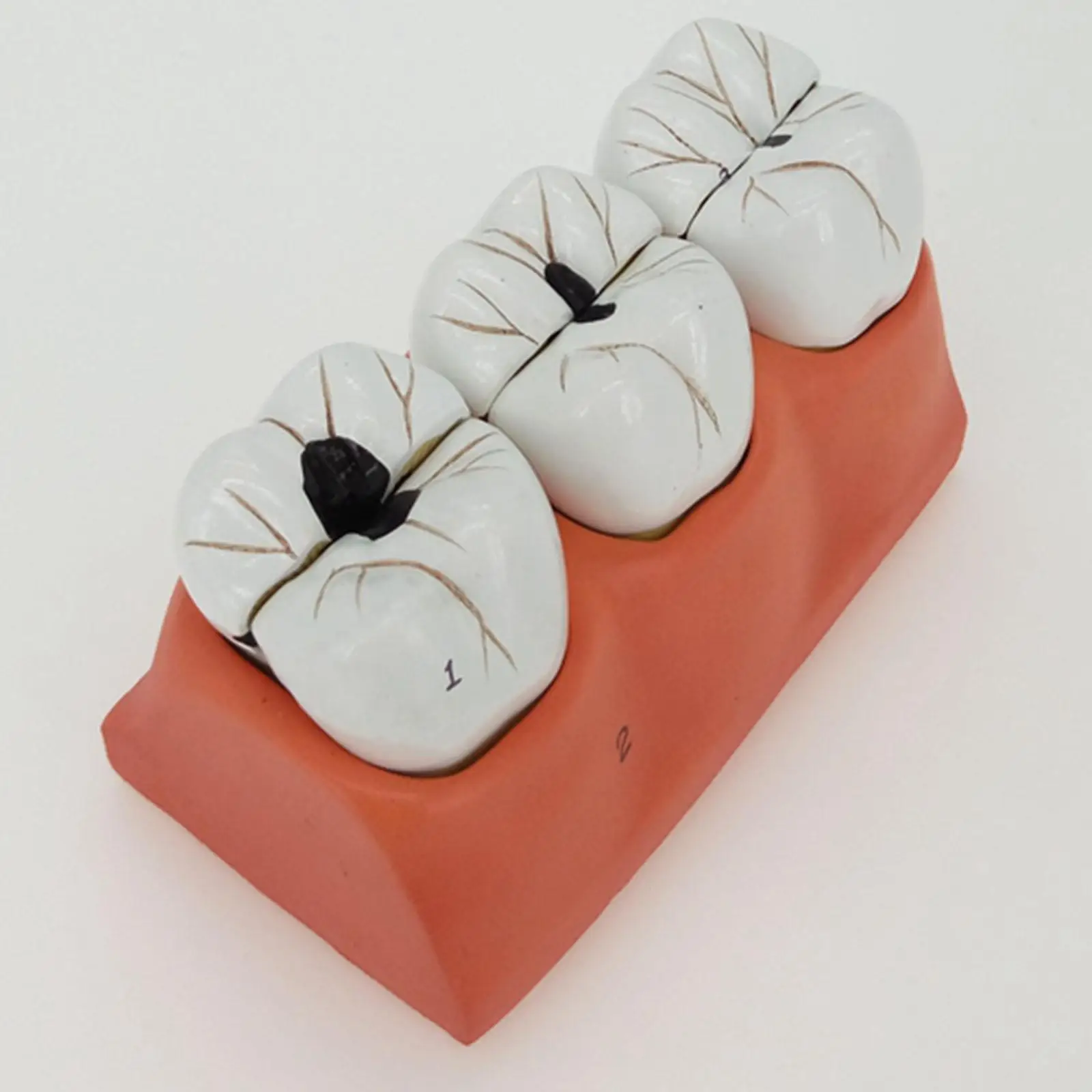 Human Dental Teeth Model Patient Education Model Caries Treatment Model for Department of Dentistry Display Teaching
Human Dental Teeth Model Patient Education Model Caries Treatment Model for Department of Dentistry Display Teaching