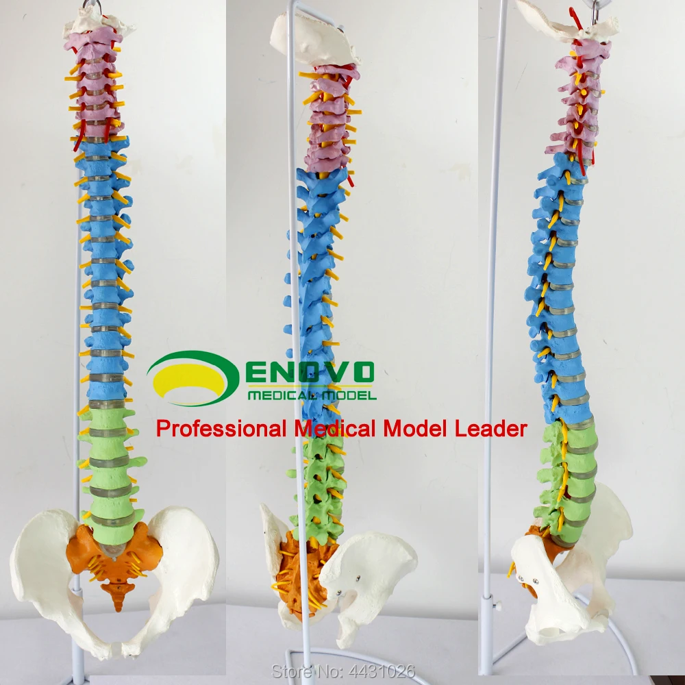 Enovo The Spine Model Of Spine Model Is Practiced In The Medical Human Body Teaching Spine Model
Enovo The Spine Model Of Spine Model Is Practiced In The Medical Human Body Teaching Spine Model