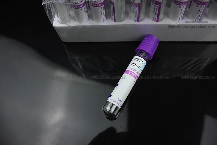 medical Disposable 2ml vacuum suction tube EDTAK2 Purple lid Routine blood test tube Purple cap Anticoagulant Collecting tube
medical Disposable 2ml vacuum suction tube EDTAK2 Purple lid Routine blood test tube Purple cap Anticoagulant Collecting tube