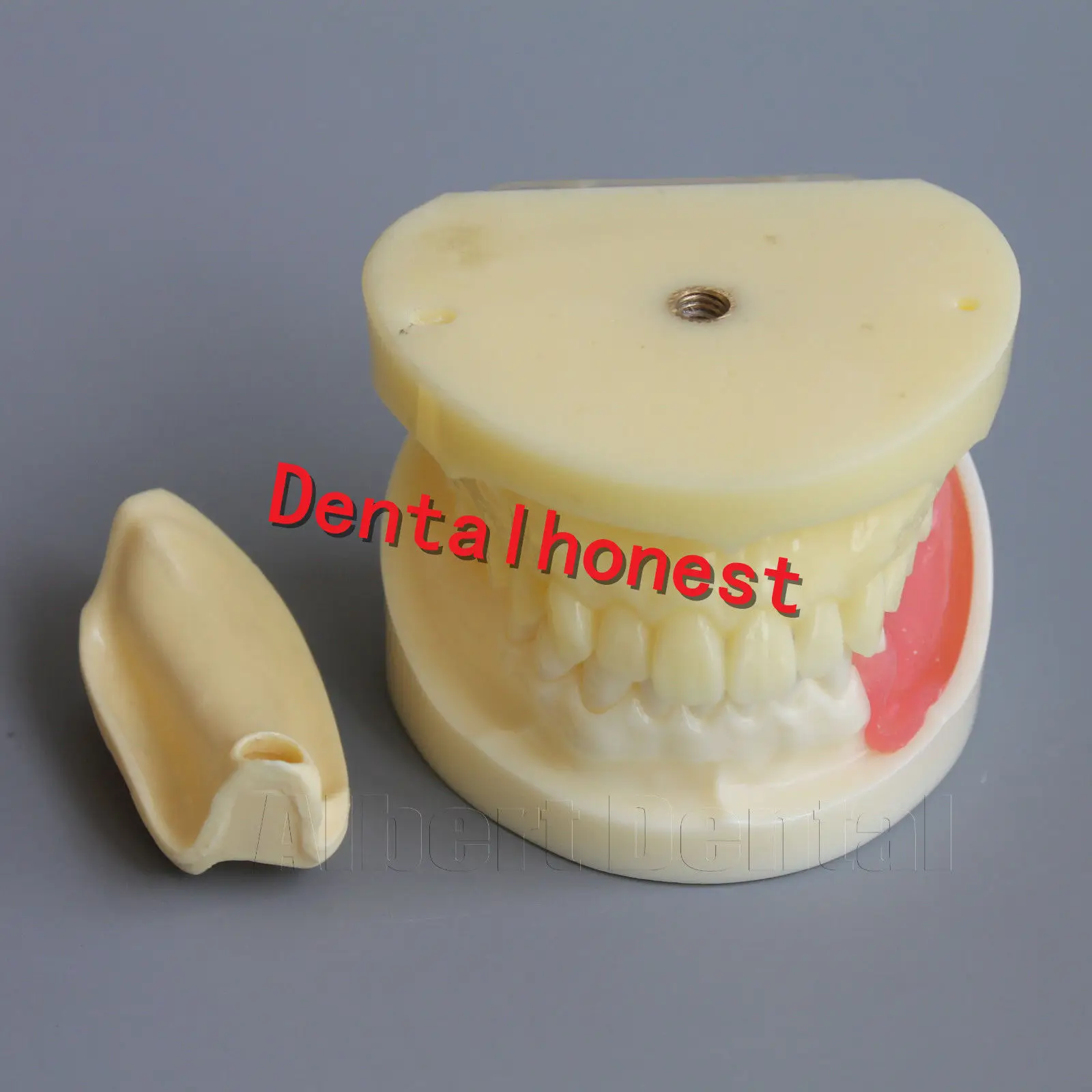 Dental Full Implant Drilling Practice Teeth Study Model Typodont Model 2002-01
Dental Full Implant Drilling Practice Teeth Study Model Typodont Model 2002-01