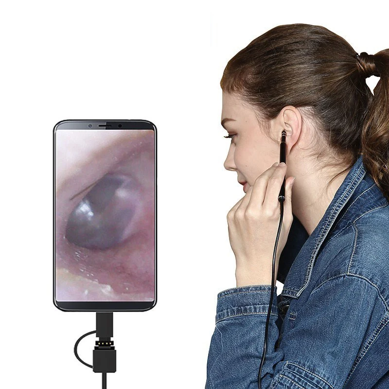 Ear Cleaning Endoscope 3 in1 USB HD Visual Ear Spoon 5.5mm Mini Camera Android PC Ear pick Otoscope Borescope Tool Health Care
Ear Cleaning Endoscope 3 in1 USB HD Visual Ear Spoon 5.5mm Mini Camera Android PC Ear pick Otoscope Borescope Tool Health Care