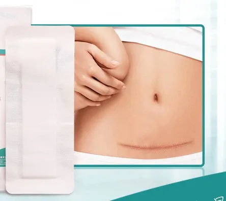 10 шт. 10 см * 25 см после сечения cesarean, животное, большая паста для ран, аппликатор, нетканая повязка на рану, хирургическая стерильная
10 шт. 10 см * 25 см после сечения cesarean, животное, большая паста для ран, аппликатор, нетканая повязка на рану, хирургическая стерильная