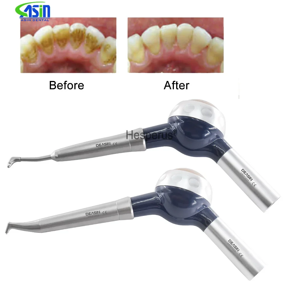 Teeth Whitening Spray Dental Air Water Polisher Fit for KAVO Coupler Oral Hygiene airFlow Sandblasting Polisher Dentistry Tool
Teeth Whitening Spray Dental Air Water Polisher Fit for KAVO Coupler Oral Hygiene airFlow Sandblasting Polisher Dentistry Tool
