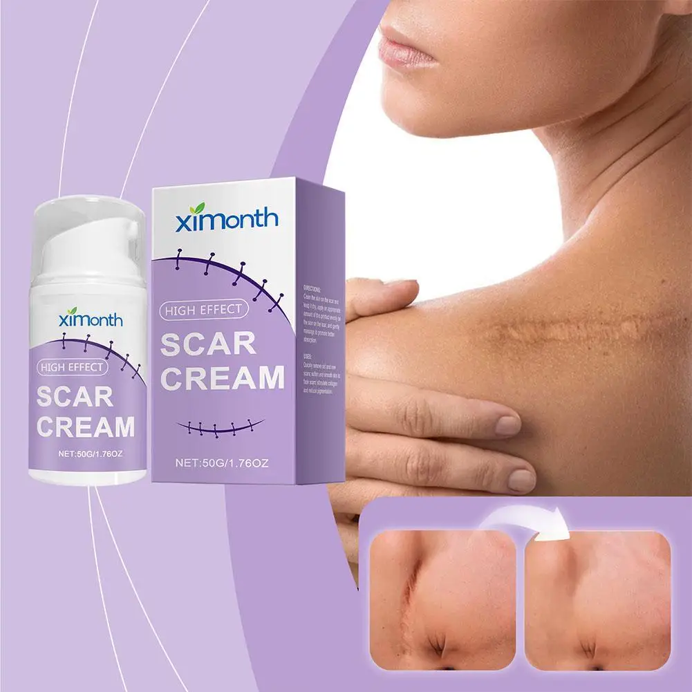 Stretch Marks Permanent Removal Cream Eliminate Body Belly Stretch Marks Swelling Marks Remove Skin Cracks Repair Firming Care
Stretch Marks Permanent Removal Cream Eliminate Body Belly Stretch Marks Swelling Marks Remove Skin Cracks Repair Firming Care