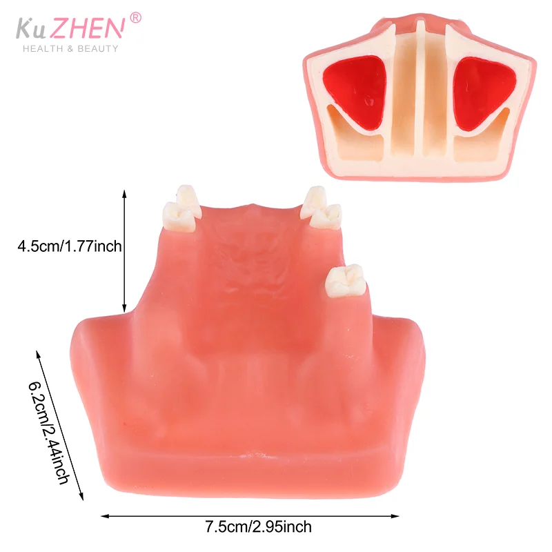 Maxillary Sinus Teeth Model Dental Implant Teaching Model For Dentist Student Practice Studying Oral Medical Lift Practice Model
Maxillary Sinus Teeth Model Dental Implant Teaching Model For Dentist Student Practice Studying Oral Medical Lift Practice Model