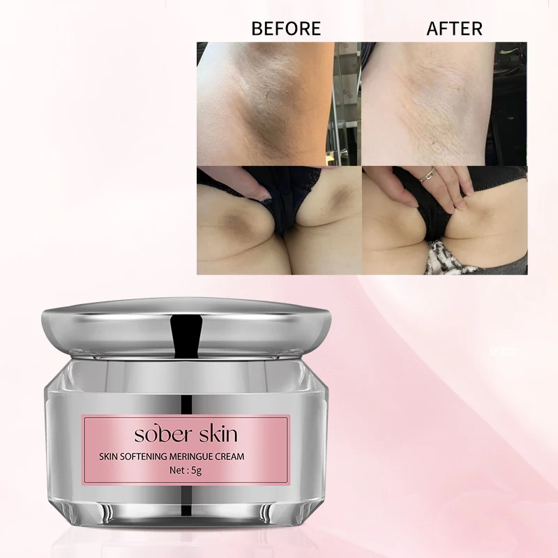 Private Parts Care Cream for Women 5g Private Part Protein Repair Remove Dark Melanin Creams Lightening Private Skin
Private Parts Care Cream for Women 5g Private Part Protein Repair Remove Dark Melanin Creams Lightening Private Skin