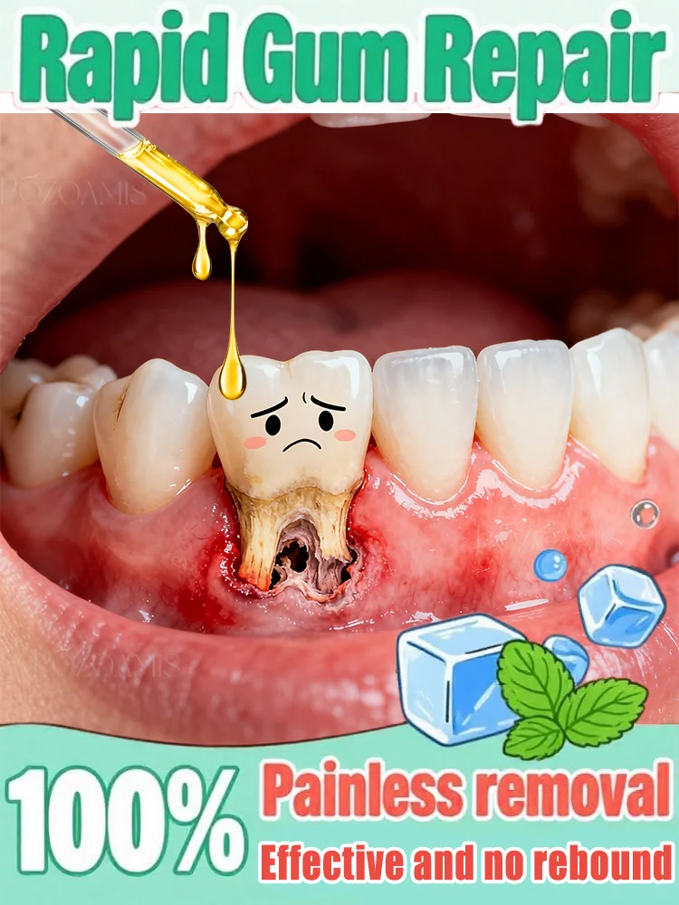 Eᴀsɪʟʏ ʀᴇɢᴇɴᴇʀᴀᴛᴇ ɢᴜᴍs ᴀɴᴅ ᴄᴏᴠᴇʀ ᴛᴇᴇᴛʜ ɪɴ 7 ᴅᴀʏs
Eᴀsɪʟʏ ʀᴇɢᴇɴᴇʀᴀᴛᴇ ɢᴜᴍs ᴀɴᴅ ᴄᴏᴠᴇʀ ᴛᴇᴇᴛʜ ɪɴ 7 ᴅᴀʏs