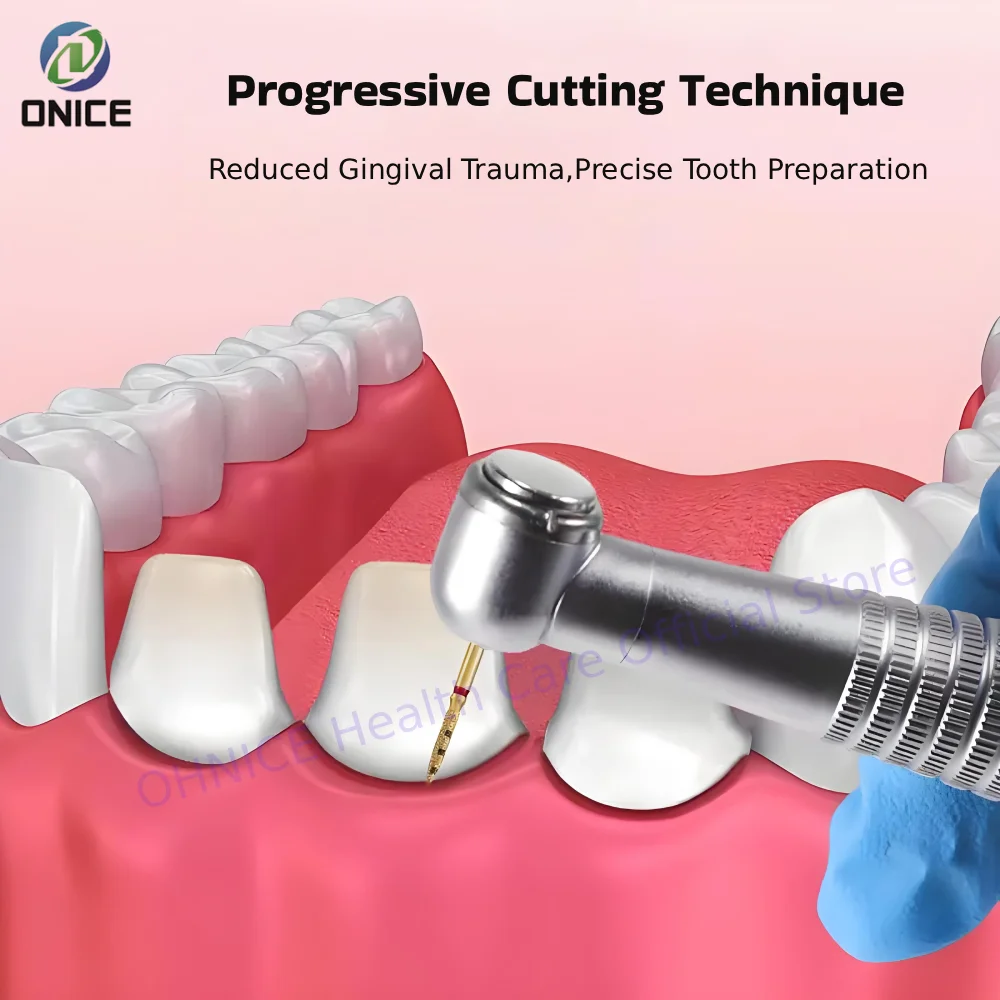 6 шт./компл. набор вертикальных стоматологических боров BOPT — инструменты для восстановления полной короны для прецизионной стоматологии (FG7906)
6 шт./компл. набор вертикальных стоматологических боров BOPT — инструменты для восстановления полной короны для прецизионной стоматологии (FG7906)