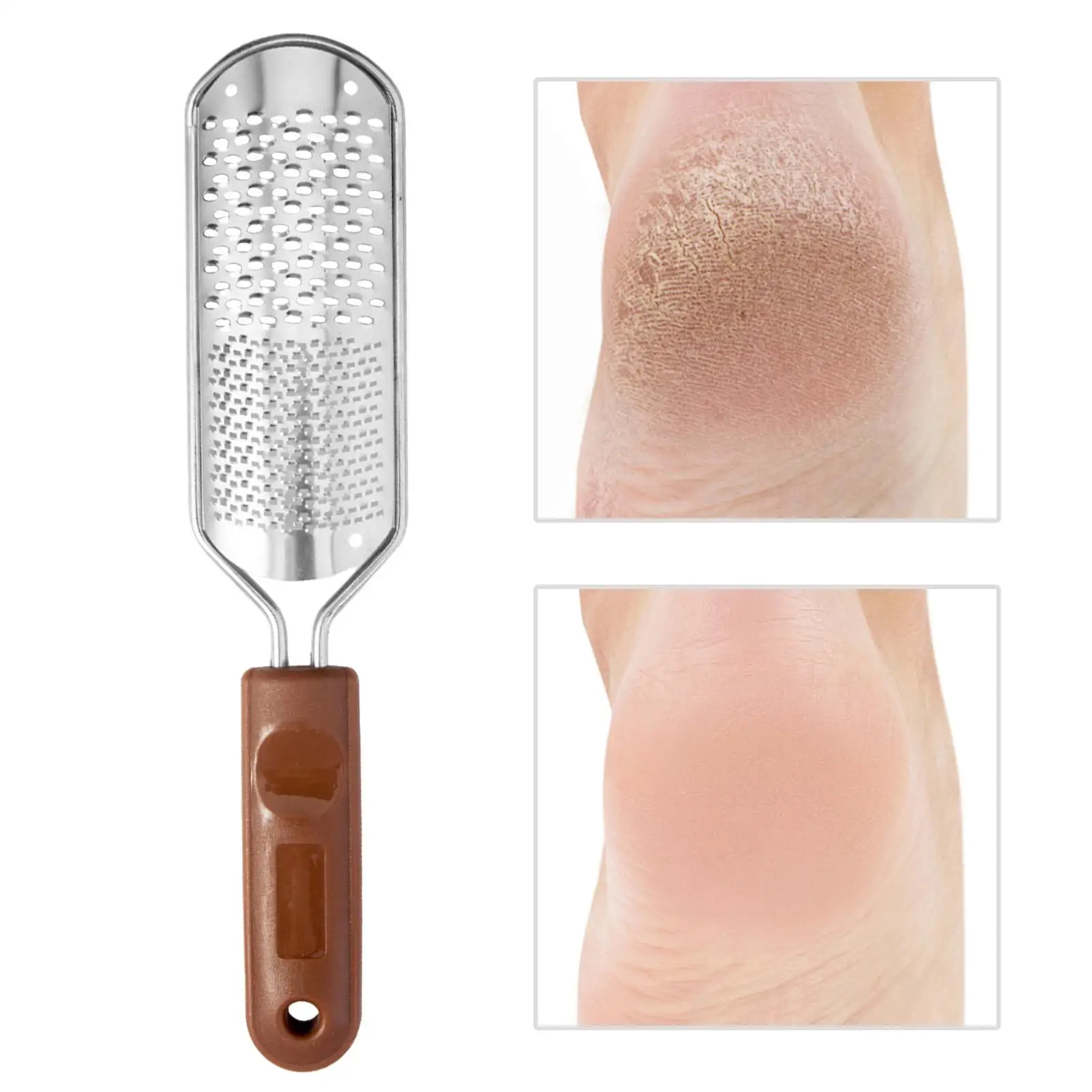 Foot File Callus Remover Metal Women Men Pedicure Tools Professional Foot Scrubber Dead Skin Remover for Hard Dead Skin Heel Dry
Foot File Callus Remover Metal Women Men Pedicure Tools Professional Foot Scrubber Dead Skin Remover for Hard Dead Skin Heel Dry
