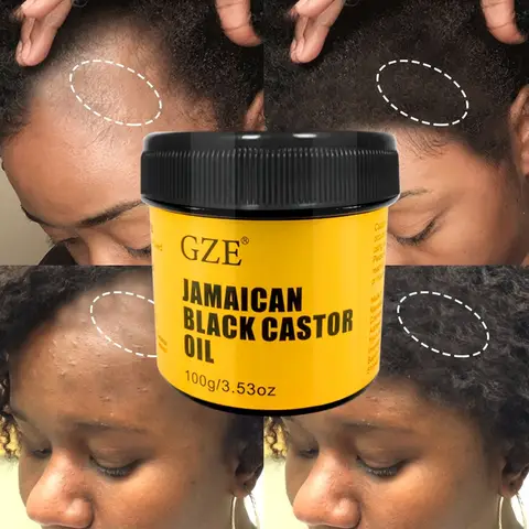 GZE JAMAICAN Huile de ricin noire pure pressée à froid pour la croissance des cheveux, l'hydratation de la peau et la santé du cuir chevelu - Promotion des cheveux épais