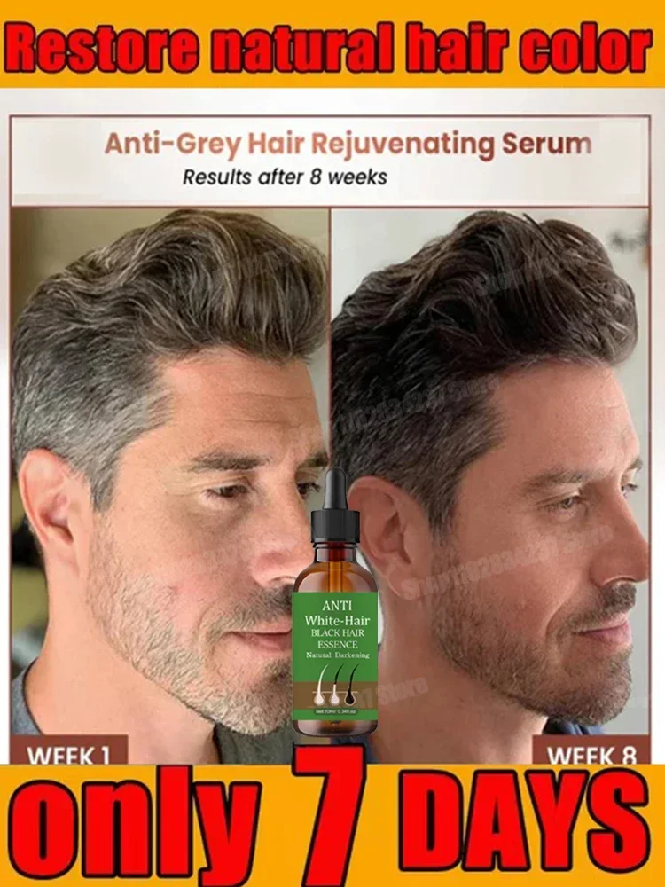 16Repair and Nourish Hair with Anti-gray Hair White to Black Natural Color Essence
16Repair and Nourish Hair with Anti-gray Hair White to Black Natural Color Essence
