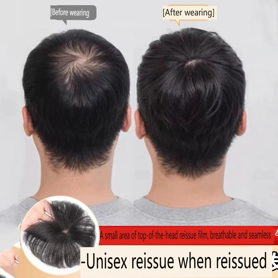 Synthetic Men's Hair Loss Cover Full Hair Top Piece Scalp Seamless Wig for Ladies Bald Spot Concealer Thickening Hair Extension
Synthetic Men's Hair Loss Cover Full Hair Top Piece Scalp Seamless Wig for Ladies Bald Spot Concealer Thickening Hair Extension