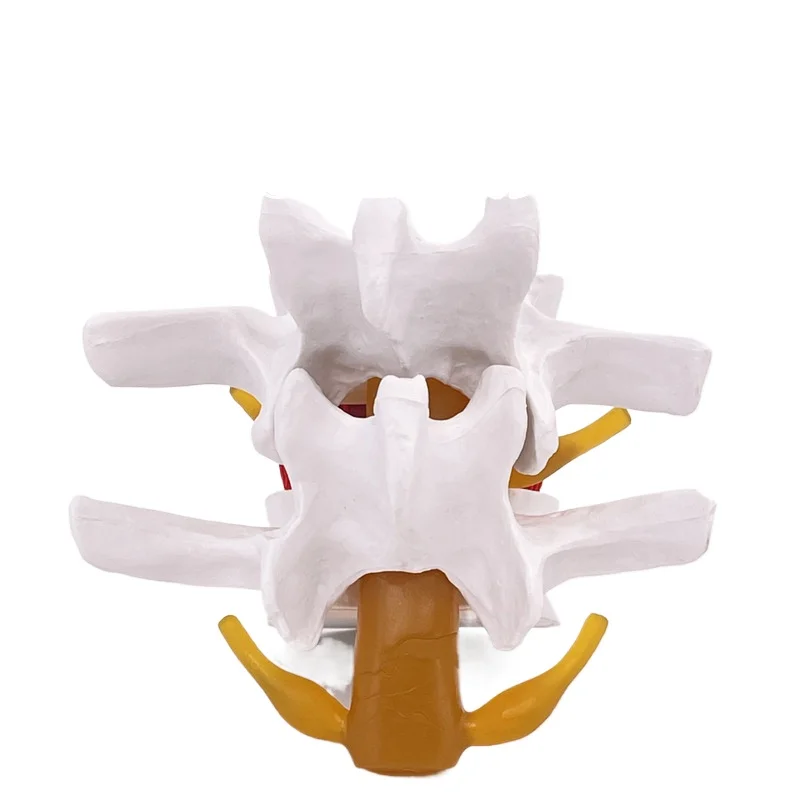 Human Anatomy Skeleton Spine Lumbar Disc Herniation Teaching Model Brain Skull Traumatic Pistol School Supplies Medical Instrume
Human Anatomy Skeleton Spine Lumbar Disc Herniation Teaching Model Brain Skull Traumatic Pistol School Supplies Medical Instrume