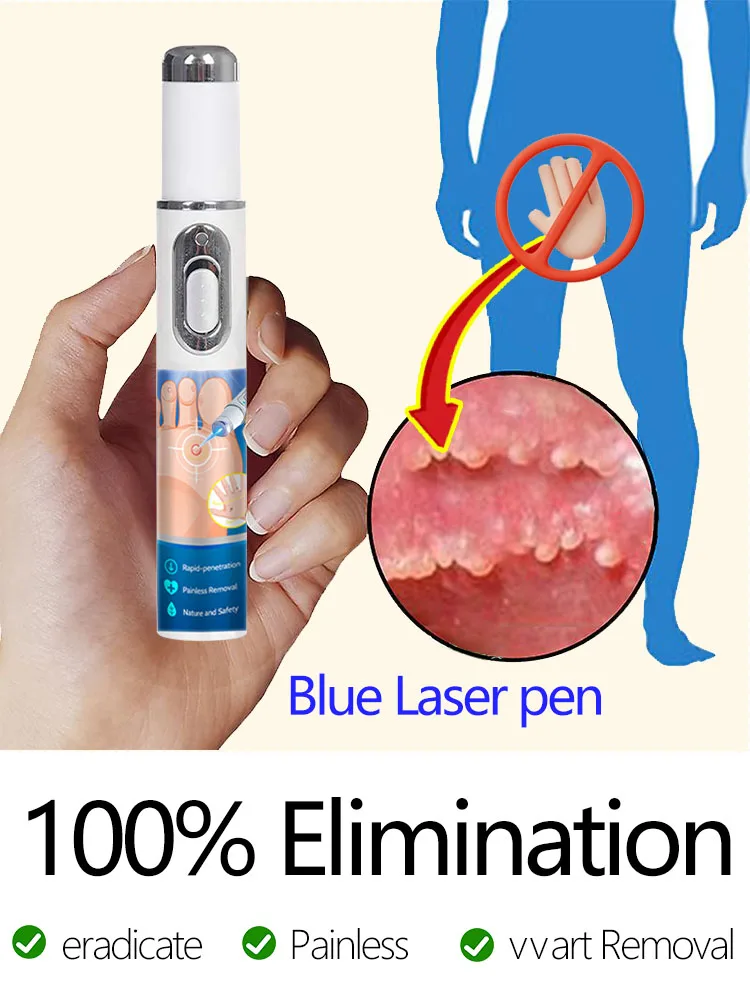 Wᴀʀᴛs ᴀʀᴇ ʀᴇᴍᴏᴠᴇᴅ ᴀɴᴅ ʏᴏᴜʀ sᴋɪɴ ᴡɪʟʟ ʙᴇ sᴍᴏᴏᴛʜ ᴀɢᴀɪɴ sᴏᴏɴ
Wᴀʀᴛs ᴀʀᴇ ʀᴇᴍᴏᴠᴇᴅ ᴀɴᴅ ʏᴏᴜʀ sᴋɪɴ ᴡɪʟʟ ʙᴇ sᴍᴏᴏᴛʜ ᴀɢᴀɪɴ sᴏᴏɴ